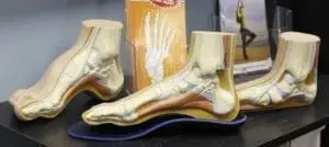 Orthotics display with anatomical foot models Physiotherapy Oakville