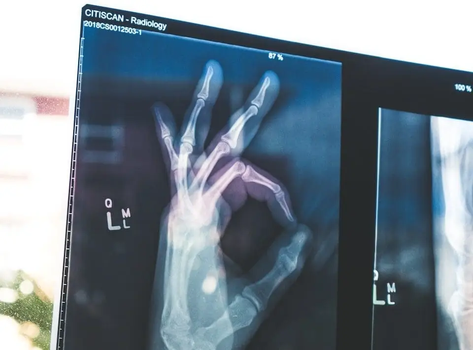 Concussions: Are they all treated the same?