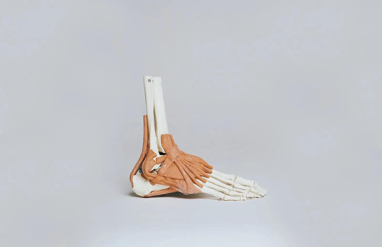 More than Orthoses: The Role of Physiotherapists in Treating Foot Pain
