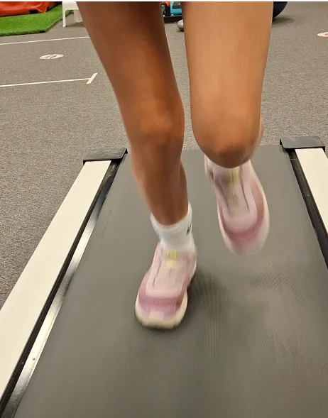 Oakville knee valgus — inward knee collapse on treadmill Oakville knee valgus — inward knee collapse on treadmill