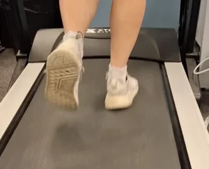 Oakville overpronation — feet on treadmill