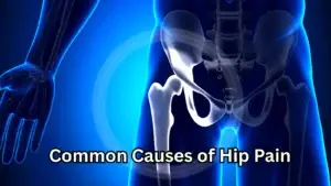 Common Causes of Hip Pain and Injuries, Oakville Common Causes of Hip Pain and Injuries, Oakville
